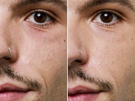 ERBORIAN SKIN THERAPY Crème Yeux Multi-Perfecteur - 15ml