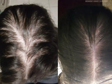 MIYÉ SÉRUM CHEVEUX Densifiant Anti-Chute - 50ml