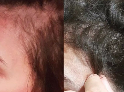 MIYÉ SÉRUM CHEVEUX Densifiant Anti-Chute - 50ml